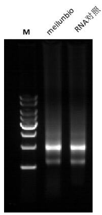 Taq DNA Polymerase (Mg2+ plus Buffer)