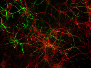 Mouse CD1 Brain Cortex Neurons