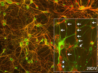 Mouse CD1 Brain Cortex Neurons