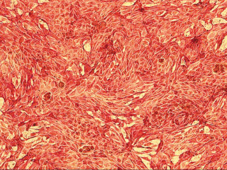 Human Intestinal Epithelial and Myofibroblast Cell Combo