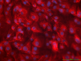 Human Intestinal Epithelial and Myofibroblast Cell Combo