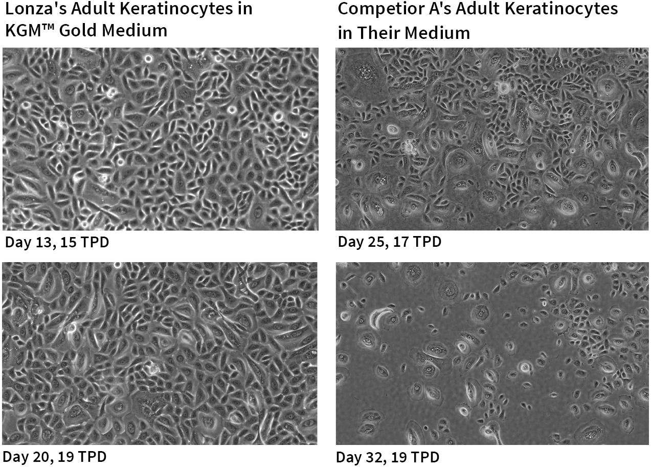 KBM™ Gold Keratinocyte Growth Basal Medium, Calcium and Phenol Red Free