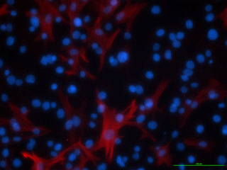 D-HBE-As – Diseased Human Bronchial/Tracheal Epithelial Cells – Asthma for B-ALI™ Culture