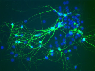 Mouse C57 Brain Cortex Neurons