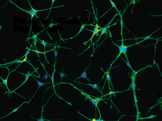 MBMTM-4 Melanocyte Growth Basal Medium-4