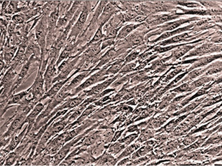 Human Bone Marrow CD34+ Progenitor Cells, Cryopreserved, 100,000