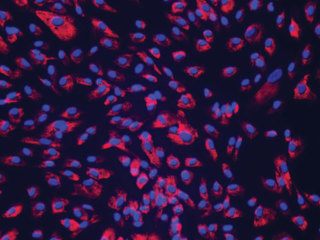 NHCF-A – Human Atrial Cardiac Fibroblasts