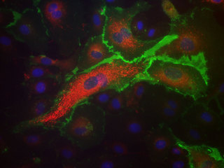 NHCF-A – Human Atrial Cardiac Fibroblasts