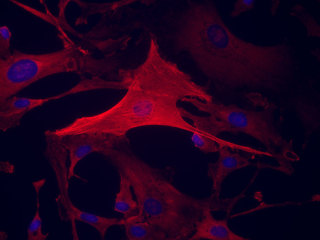 NHCF-A – Human Atrial Cardiac Fibroblasts