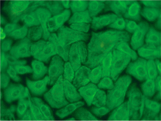 SAEC &ndash; Small Airway Epithelial Cells for S-ALITM Small Airway Air-Liquid-Interface Medium