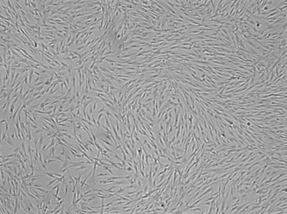 SAEC &ndash; Small Airway Epithelial Cells for S-ALITM Small Airway Air-Liquid-Interface Medium