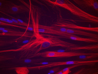 SKBM™- 2 Skeletal Muscle Cell Growth Basal Medium-2