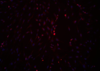 TGF Beta 3 for hMSC Chondrogenic Differentiation Kit