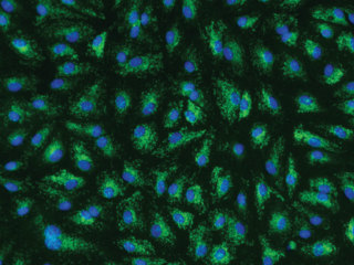 BSMC – Human Bronchial Smooth Muscle Cells