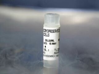 Unprocessed Human Bone Marrow, Fresh, 10 mL