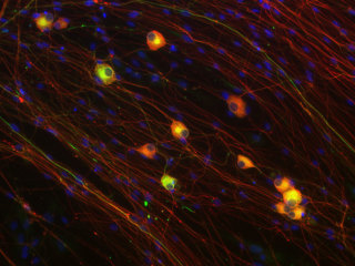 Rat Neonatal Dorsal Root Ganglion (DRG) Neurons