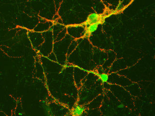 PNGM™ Primary Neuron Growth Medium BulletKit™