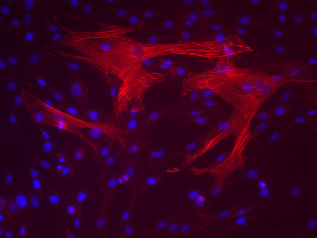 PASMC - Human Pulmonary Artery Smooth Muscle Cells