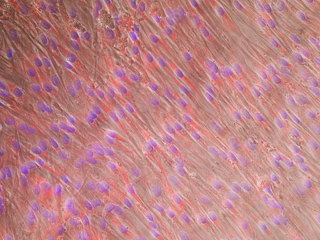 HPAEC – Human Pulmonary Artery Endothelial Cells