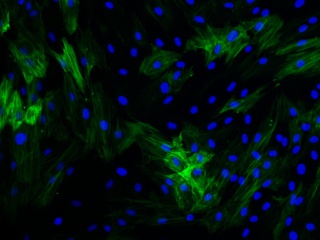 HPAEC – Human Pulmonary Artery Endothelial Cells