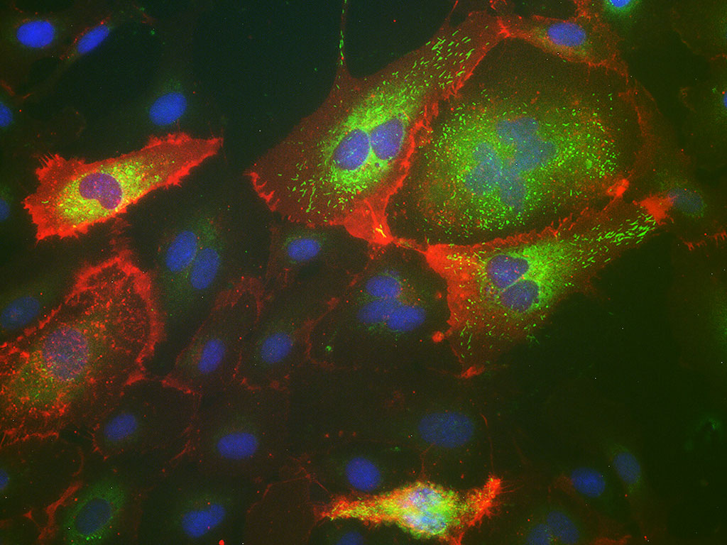 HPAEC – Human Pulmonary Artery Endothelial Cells