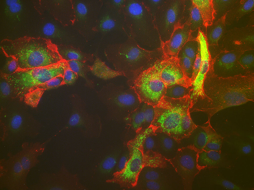 HPAEC – Human Pulmonary Artery Endothelial Cells