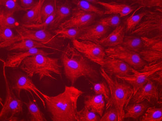 NHOst – Human Osteoblasts