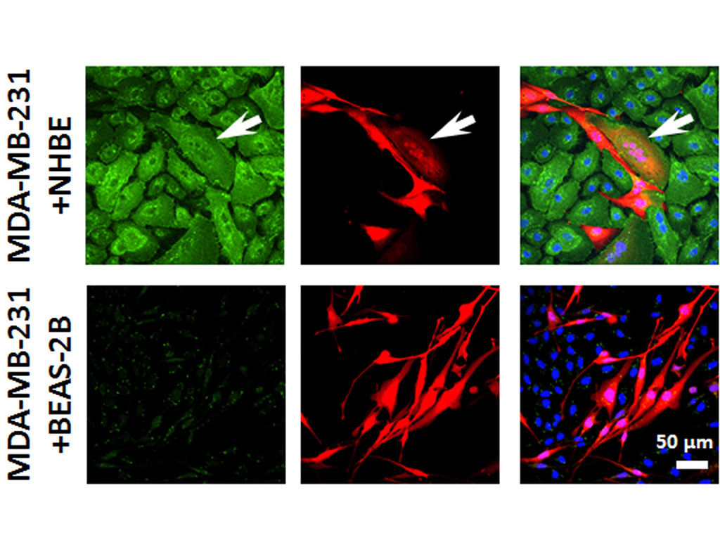 NHBE – Human Bronchial/Tracheal Epithelial Cells without Retinoic Acid