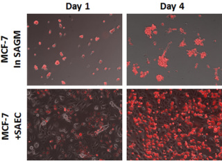 BEGMTM Bronchial Epithelial SingleQuotsTM Kit