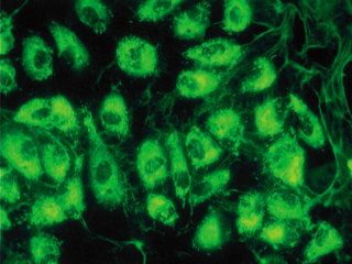 HAEC – Human Aortic Endothelial Cells