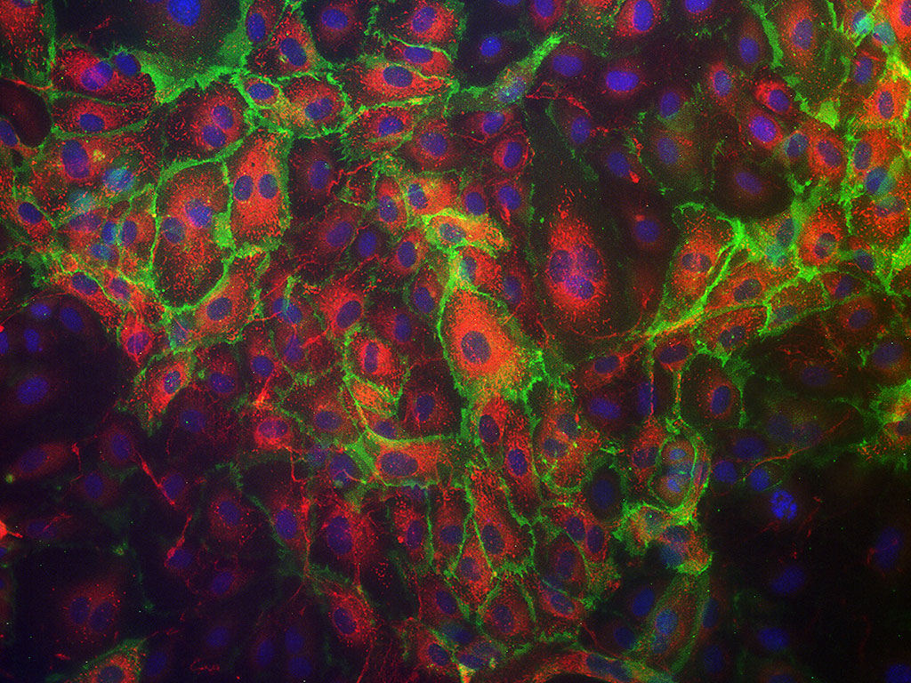 HAEC – Human Aortic Endothelial Cells