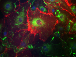 NHDF-Ad - Human Dermal Fibroblasts, Adult