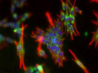 NHDF-Ad - Human Dermal Fibroblasts, Adult