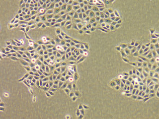 NHDF-Ad - Human Dermal Fibroblasts, Adult