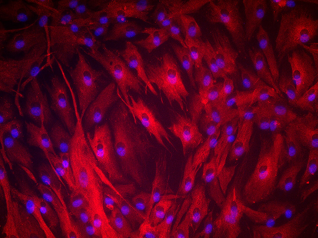 NHDF-Ad - Human Dermal Fibroblasts, Adult