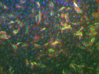 EGMTM-2 Endothelial SingleQuotsTM Kit