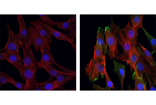 CST   Phospho-Akt (Ser473) (D9E) XP ® Rabbit mAb  4060T 4060L 4060S