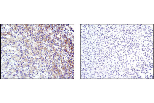 CST   Phospho-Akt (Ser473) (D9E) XP ® Rabbit mAb  4060T 4060L 4060S