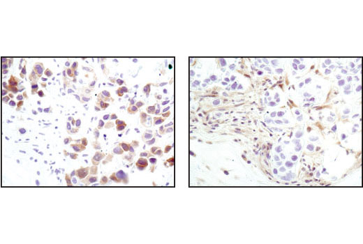 CST   Phospho-Akt (Ser473) (D9E) XP ® Rabbit mAb  4060T 4060L 4060S