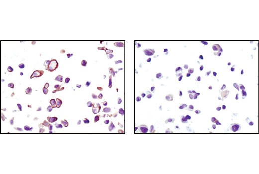 CST   Phospho-Akt (Ser473) (D9E) XP ® Rabbit mAb  4060T 4060L 4060S