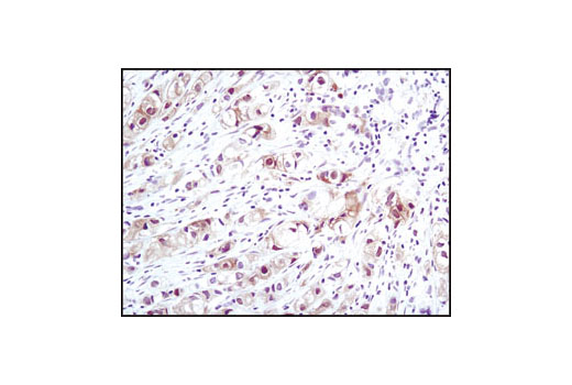 CST   Phospho-Akt (Ser473) (D9E) XP ® Rabbit mAb  4060T 4060L 4060S