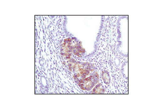 CST   Phospho-Akt (Ser473) (D9E) XP ® Rabbit mAb  4060T 4060L 4060S