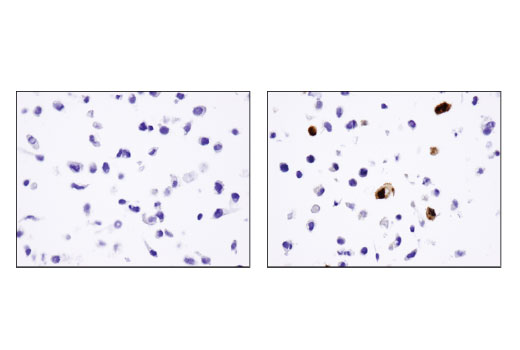 CST   14793S  DYKDDDDK Tag (D6W5B) Rabbit mAb (Binds to same epitope as Sigma's Anti-FLAG ® M2 Antibody)