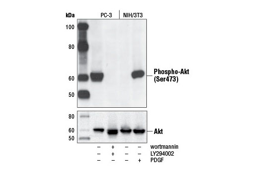 CST   Phospho-Akt (Ser473) (D9E) XP ® Rabbit mAb  4060S 4060T 4060L