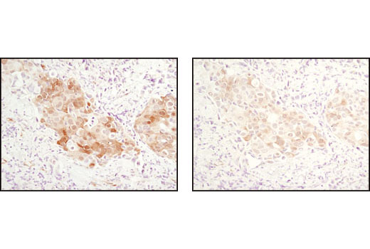 CST   Phospho-Akt (Ser473) (D9E) XP ® Rabbit mAb  4060S 4060T 4060L