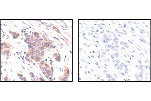 CST   p44/42 MAPK (Erk1/2) (137F5) Rabbit mAb  4695S 4695T