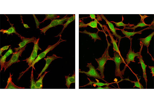 CST   p44/42 MAPK (Erk1/2) (137F5) Rabbit mAb  4695S 4695T