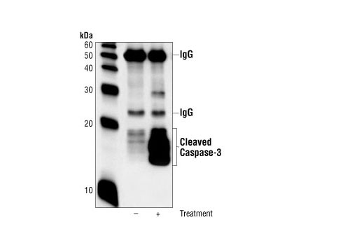 CST   Cleaved Caspase-3 (Asp175) (5A1E) Rabbit mAb  9664S 9664L 9664T