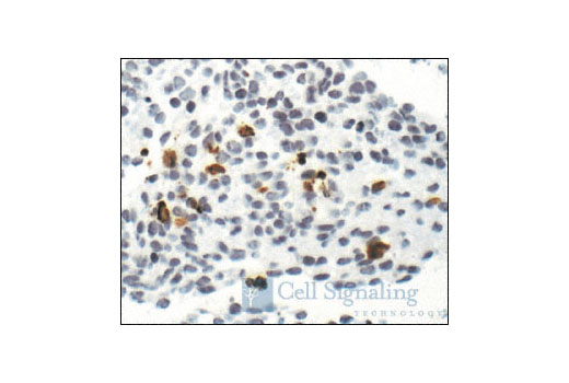 CST   Cleaved Caspase-3 (Asp175) (5A1E) Rabbit mAb  9664S 9664L 9664T