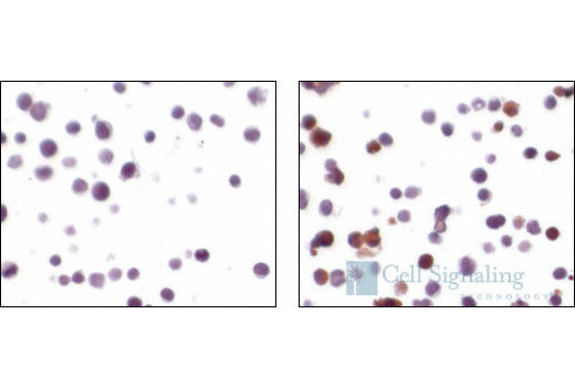 CST   Cleaved Caspase-3 (Asp175) (5A1E) Rabbit mAb  9664S 9664L 9664T